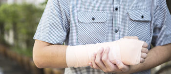 Man with arm cast