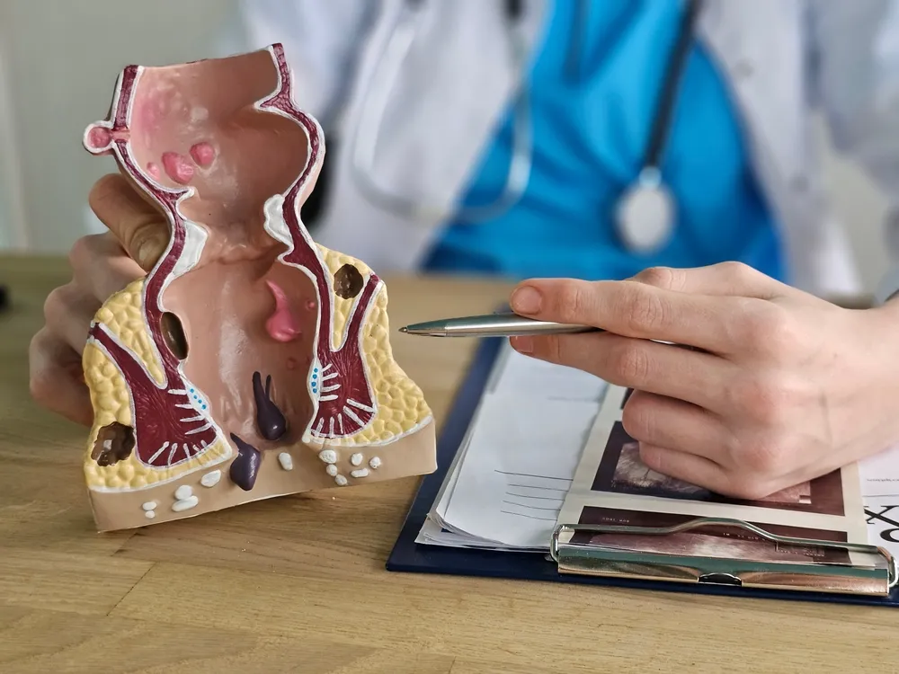A doctor holds a detailed model of a rectum.